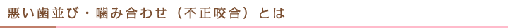 悪い歯並び・噛み合わせ（不正咬合）とは