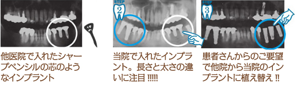 レントゲン画像